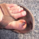 toe